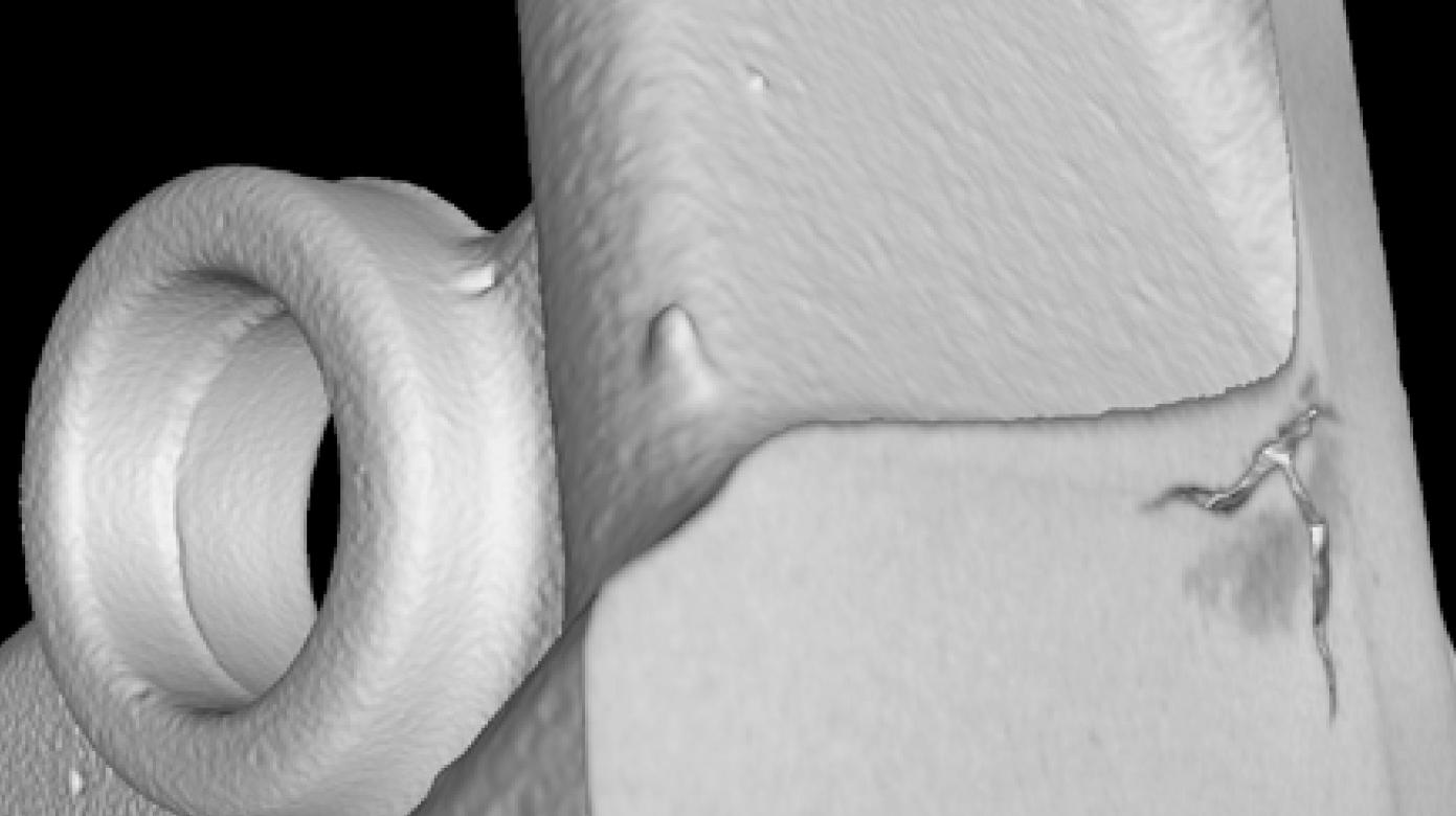 ZEISS zones spongieuses de métaux légers