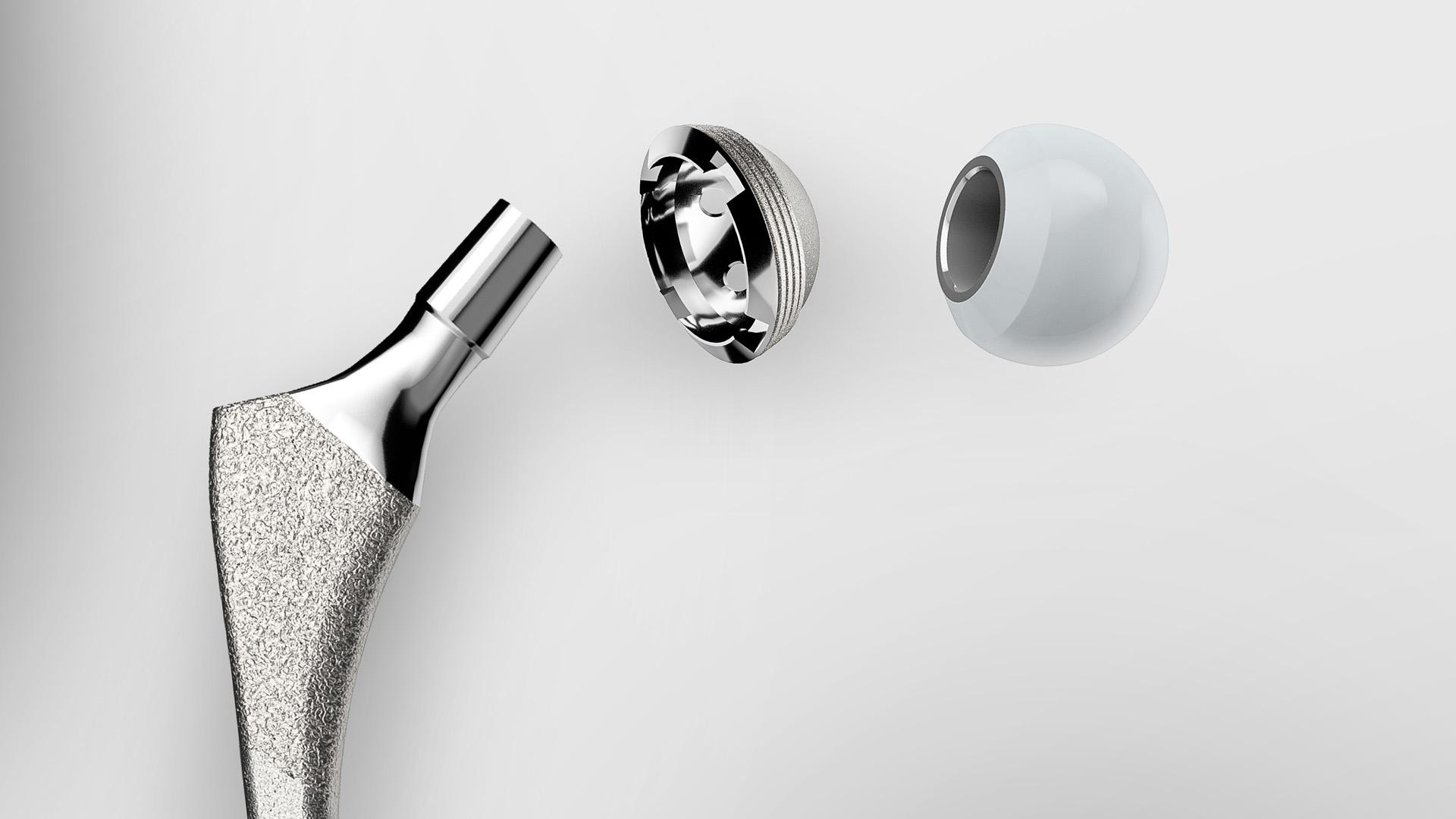 Découvrez les passerelles de qualité et les solutions pour le processus de production d'implants orthopédiques