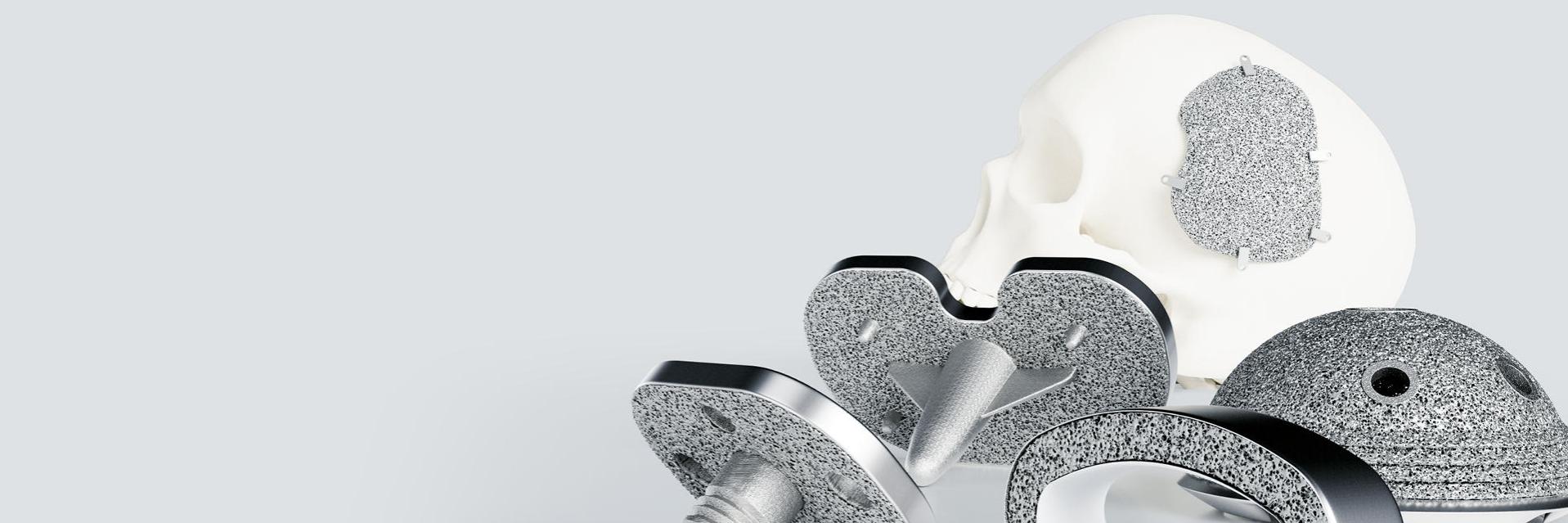 Contrôle qualité pour les implants fabriqués par prototypage rapide