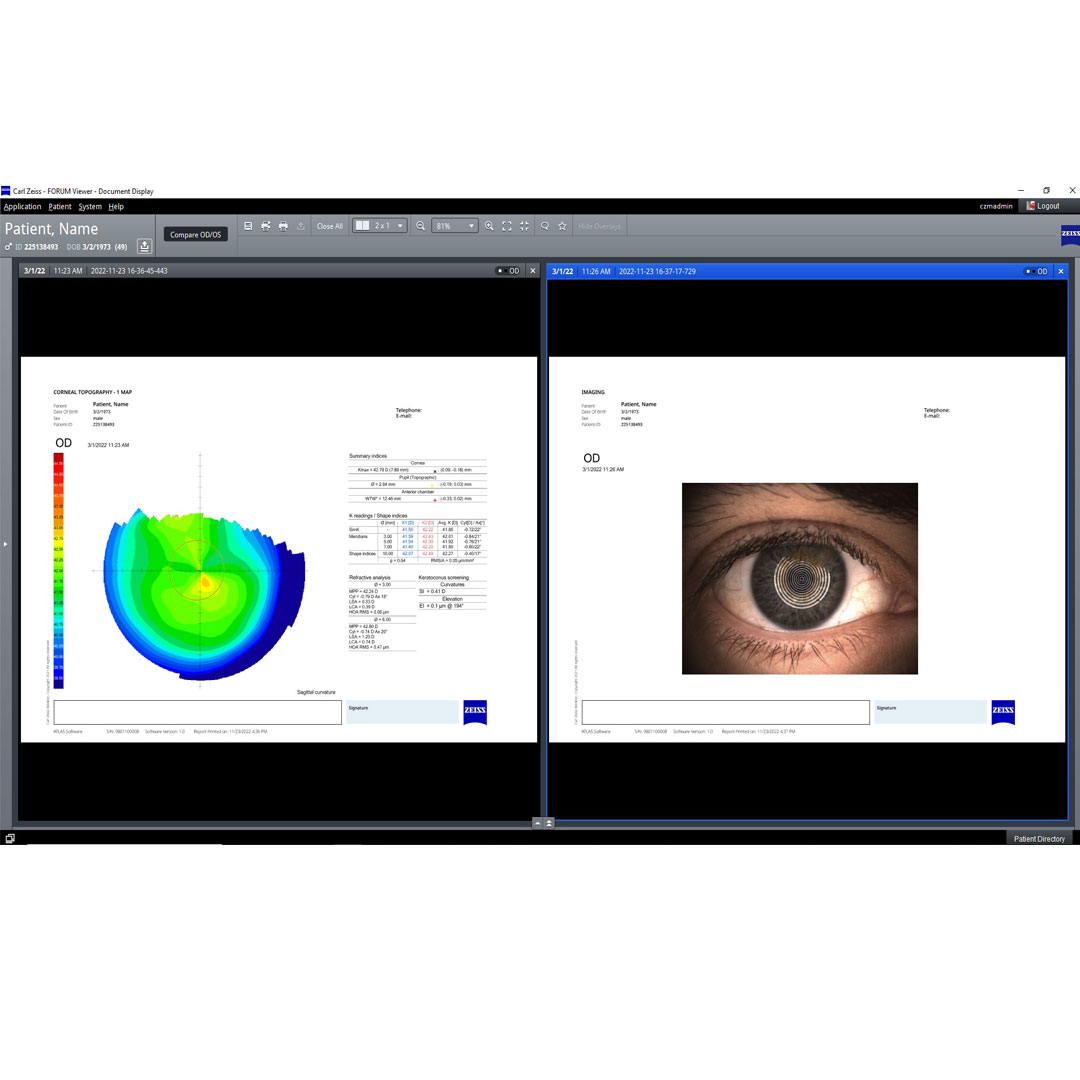 Multi-modality worklists in FORUM