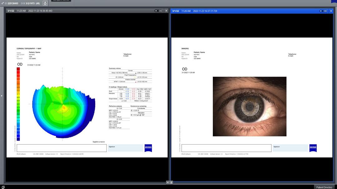 Multi-modality worklists in FORUM