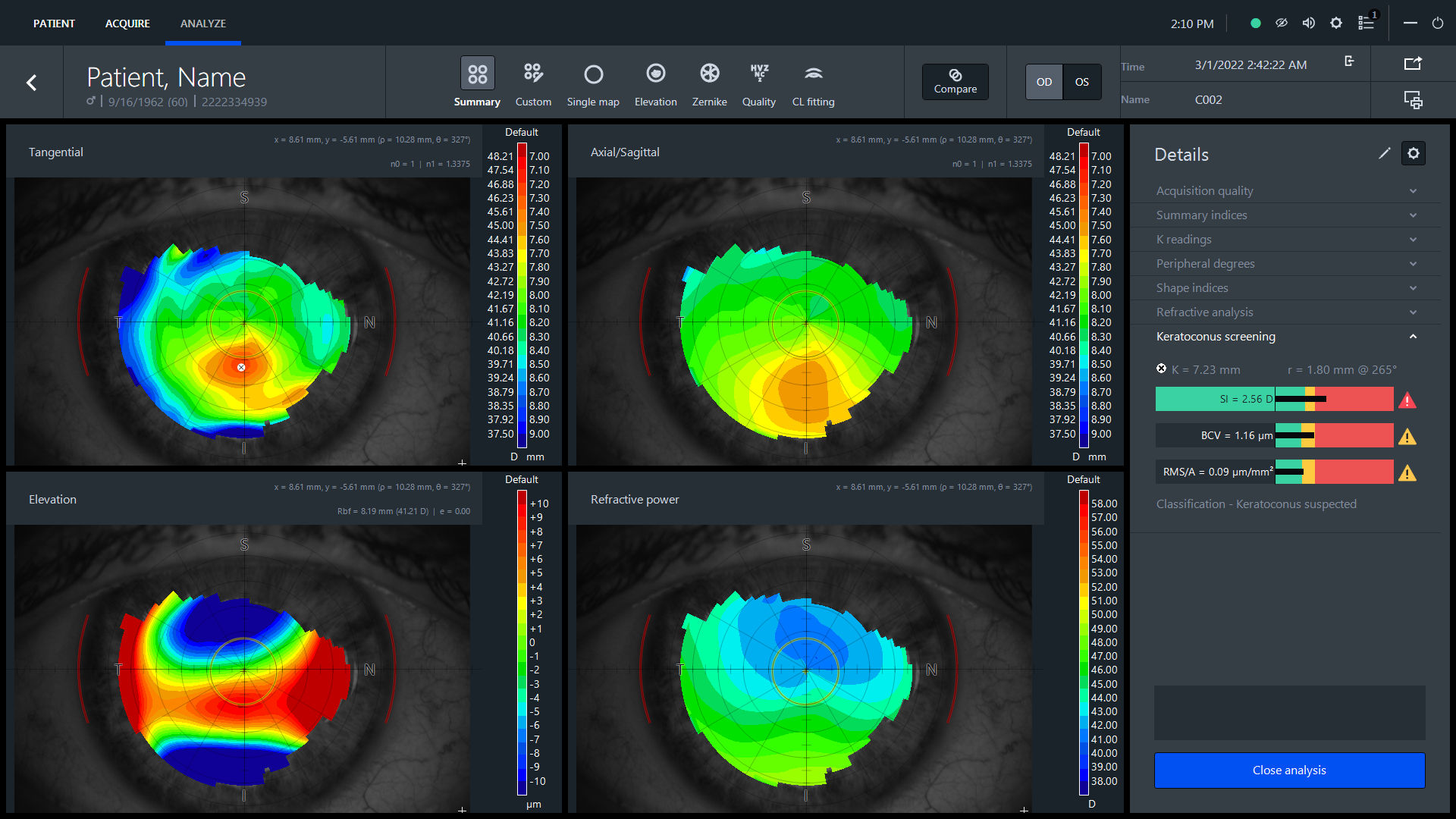 Keratoconus screening including classification