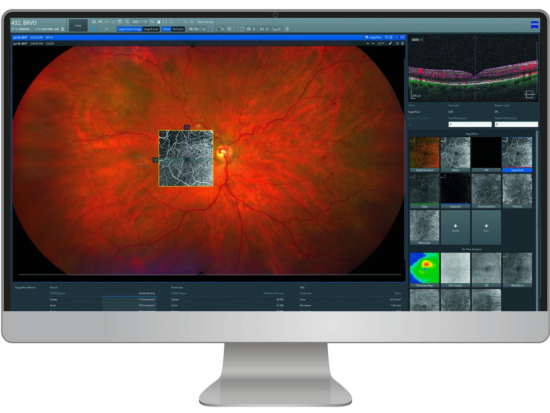 ZEISS Retina Workplace
