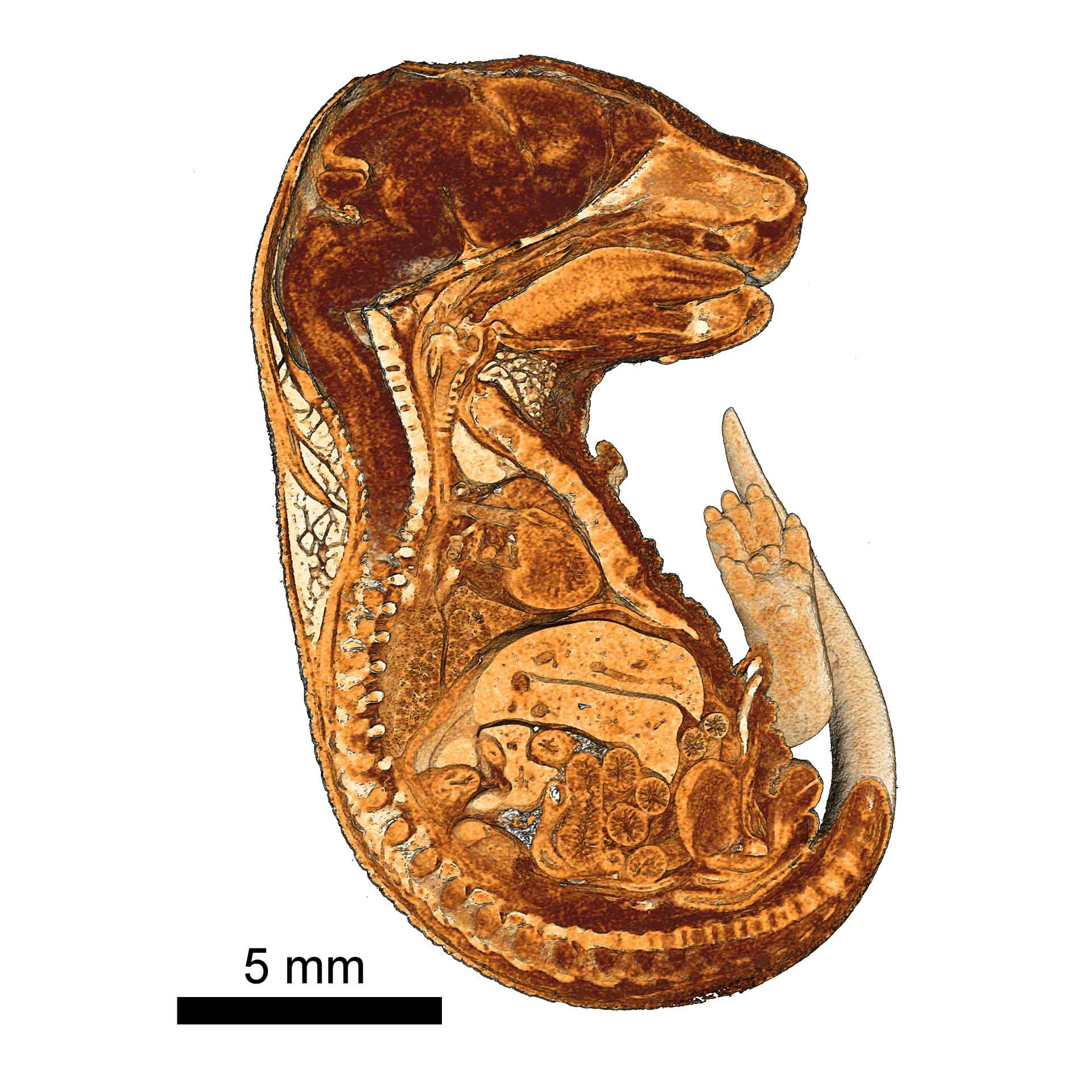 Visualisation d'organes divers dans un embryon de souris enrobé de résine