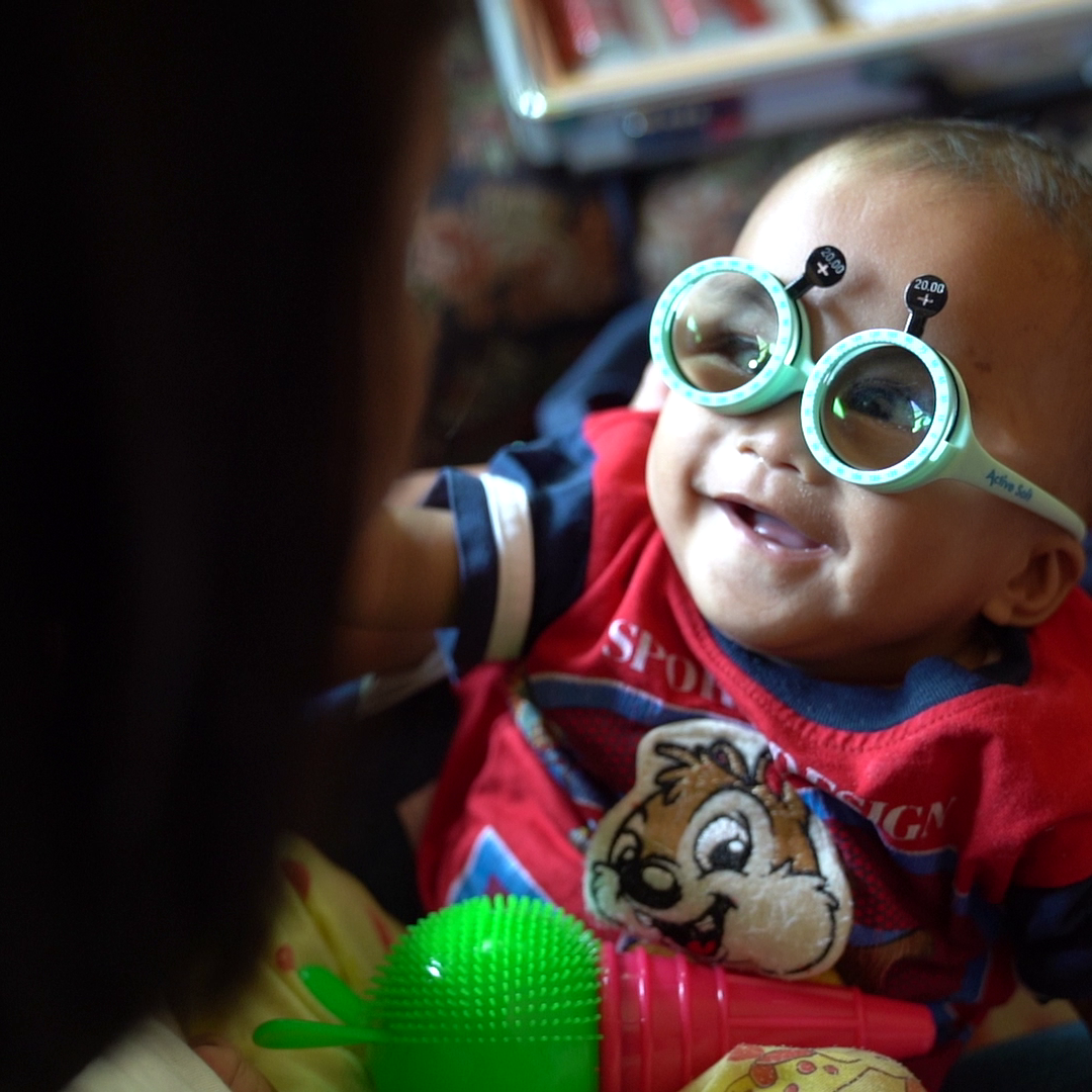 Baby with congenital cataracts