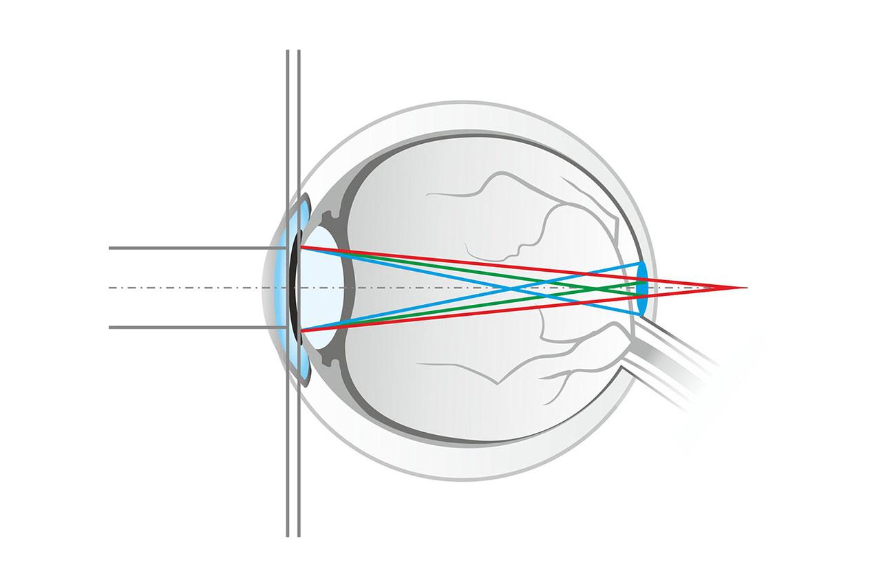 Les lunettes qui filtrent la lumière bleue n'auraient aucun effet bénéfique  sur la santé